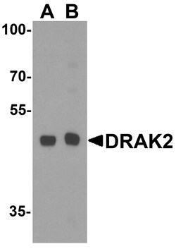 ProSci&nbsp;DRAK2 Peptide
