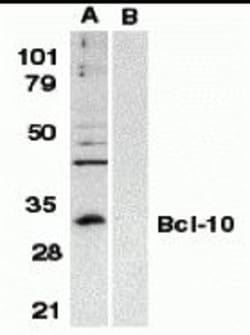 ProSci&nbsp;BCL-10 Peptide