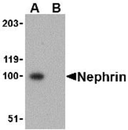 ProSci&nbsp;Nephrin Peptide