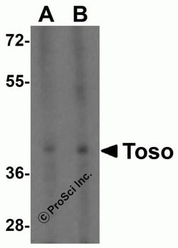 ProSci&nbsp;Toso Peptide