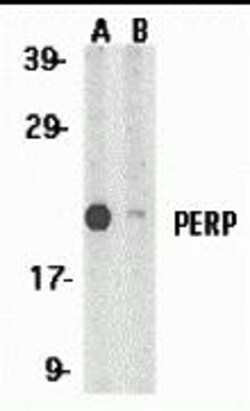 ProSci&nbsp;PERP Peptide