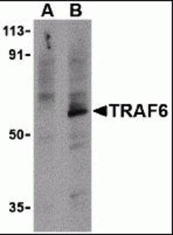 ProSci&nbsp;TRAF6 Peptide