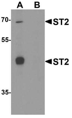 ProSci&nbsp;ST2 Peptide