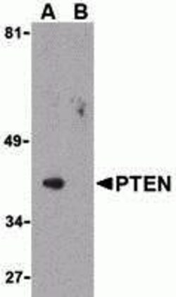 ProSci&nbsp;PTEN Peptide