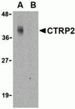 ProSci&nbsp;CTRP2 Peptide