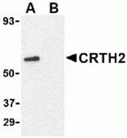 ProSci&nbsp;CRTH2 Peptide