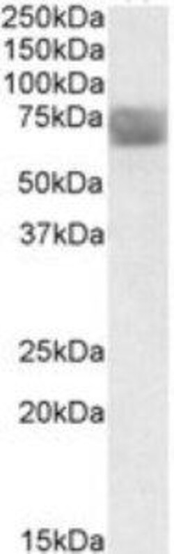 ProSci&nbsp;TPP1 Peptide