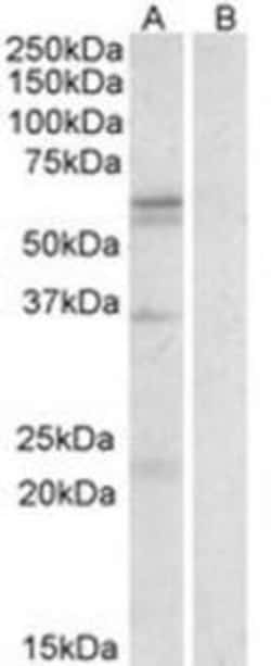 ProSci&nbsp;SLC7A5 Peptide