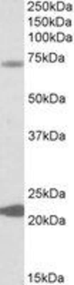 ProSci&nbsp;KCNN2 Peptide