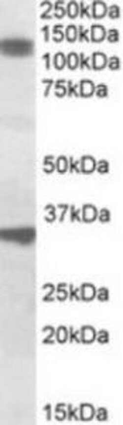 ProSci&nbsp;CCAR1 Peptide
