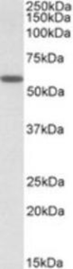 ProSci&nbsp;DIXDC1 Peptide