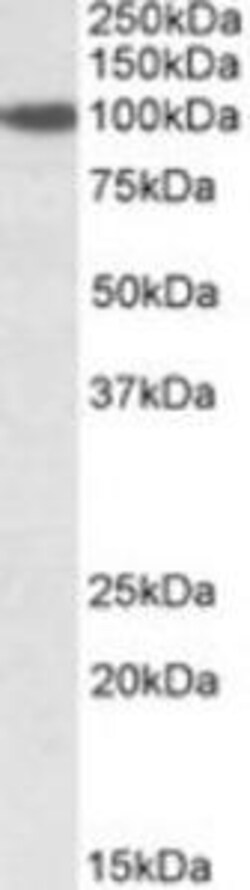 ProSci&nbsp;SEC23A Peptide