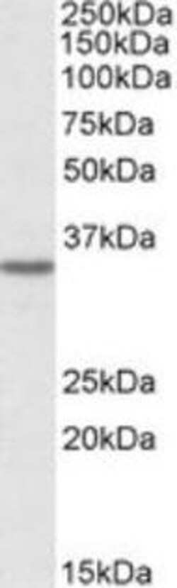 ProSci&nbsp;GHITM Peptide