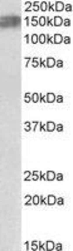 ProSci&nbsp;Alk Peptide