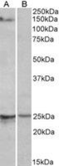 ProSci&nbsp;RBM20 Peptide