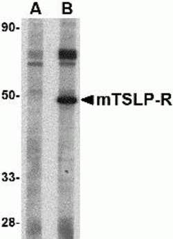 ProSci&nbsp;TSLP Receptor Peptide