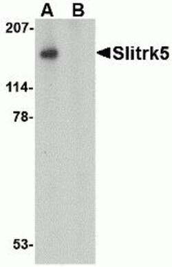 ProSci&nbsp;Slitrk5 Peptide
