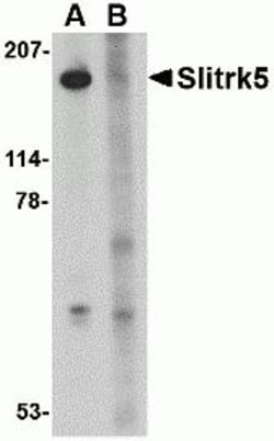 ProSci&nbsp;Slitrk5 Peptide