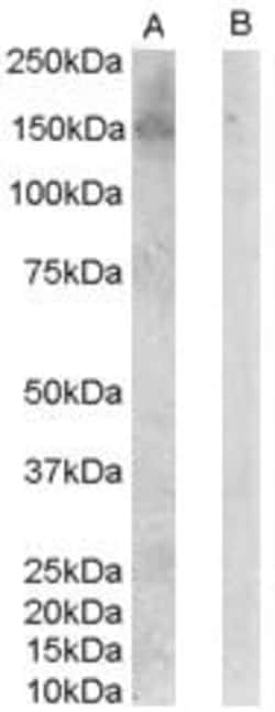 ProSci&nbsp;ERBB3 Peptide