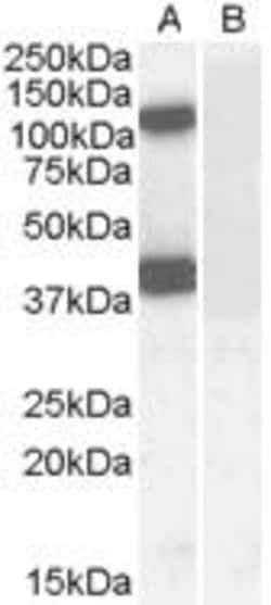 ProSci&nbsp;EPB41L2 Peptide