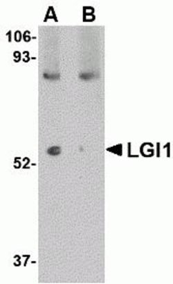 ProSci&nbsp;LGI1 Peptide