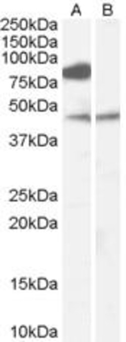 ProSci&nbsp;ZDHHC8 Peptide