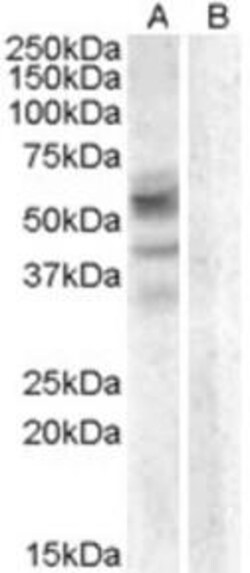 ProSci&nbsp;Arylsulfatase D Peptide