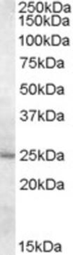 ProSci&nbsp;MTHFS Peptide