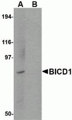ProSci&nbsp;BICD1 Peptide
