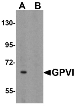 ProSci&nbsp;GPVI Peptide