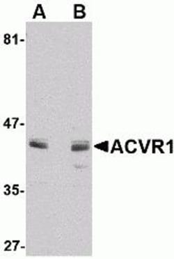 ProSci&nbsp;ACVR1 Peptide