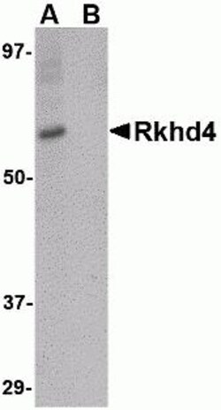 ProSci&nbsp;Rkhd4 Peptide