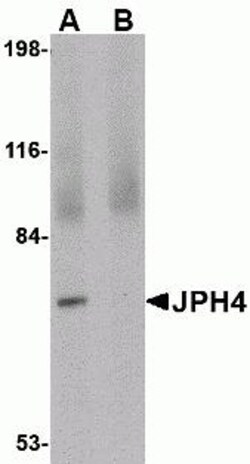 ProSci&nbsp;JPH4 Peptide