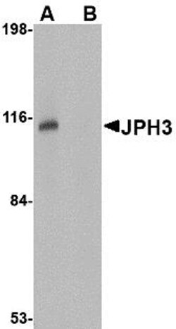ProSci&nbsp;JPH3 Peptide