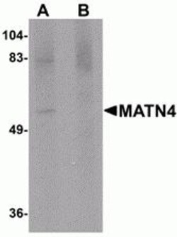 ProSci&nbsp;MATN4 Peptide