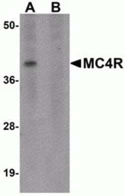 ProSci&nbsp;MC4R Peptide