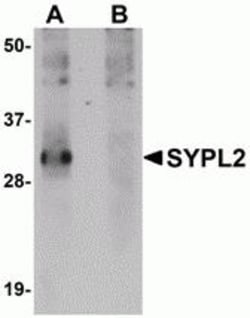 ProSci&nbsp;SYPL2 Peptide