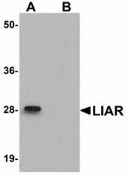 ProSci&nbsp;LIAR Peptide