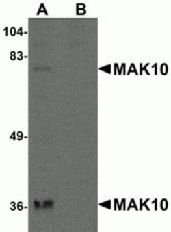 ProSci&nbsp;MAK10 Peptide