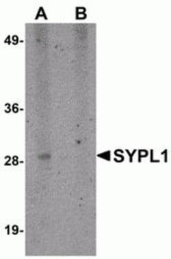 ProSci&nbsp;SYPL1 Peptide