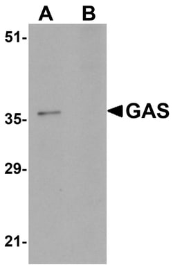 ProSci&nbsp;GAS Peptide