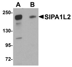 ProSci&nbsp;SIPA1L2 Peptide