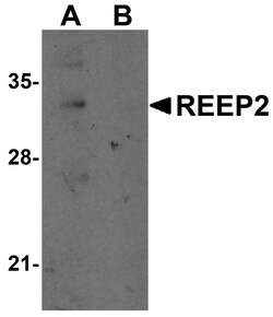 ProSci&nbsp;REEP2 Peptide