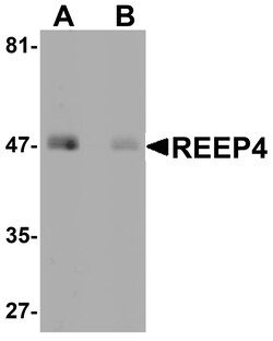 ProSci&nbsp;REEP4 Peptide