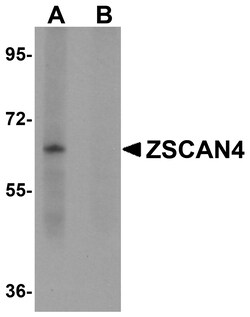 ProSci&nbsp;ZSCAN4 Peptide