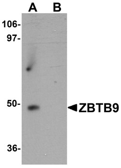 ProSci&nbsp;ZBTB9 Peptide