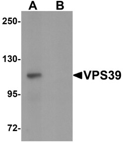ProSci&nbsp;VPS39 Peptide