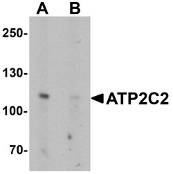 ProSci&nbsp;ATP2C2 Peptide