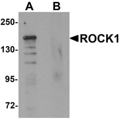 ProSci&nbsp;ROCK1 Peptide