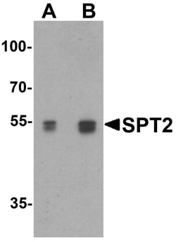 ProSci&nbsp;SPT2 Peptide